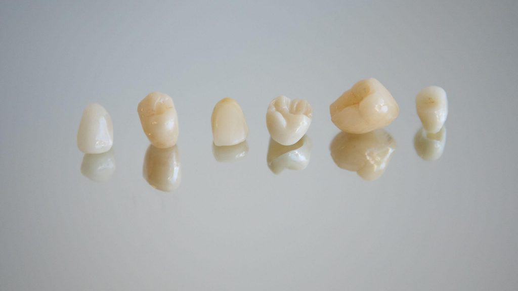 dental crowns
