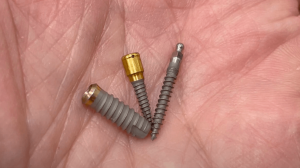 mini dental implants