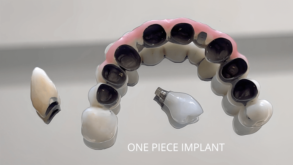 perspective views of single dental implant and multiple dental implants