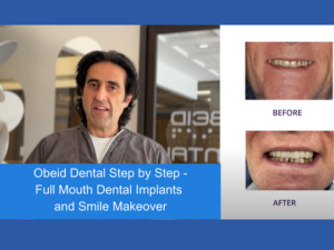 Prosthodontist Dr. Obeid with before and after picture of a smile makeover beside him